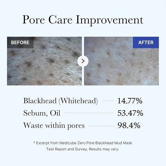 MEDICUBE ZERO PORE BLACKHEAD MUD MASK