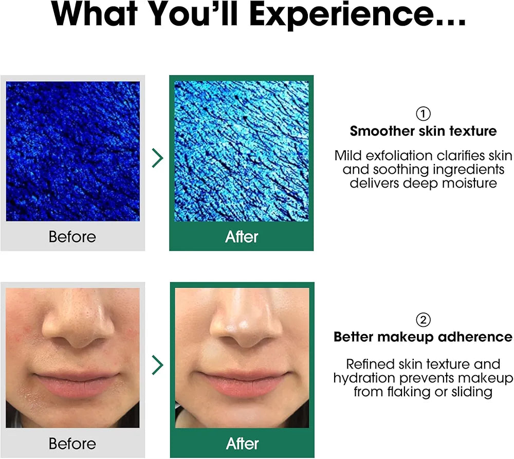 Some by mi Aha bha pha 30 days miracle toner 150 ML
