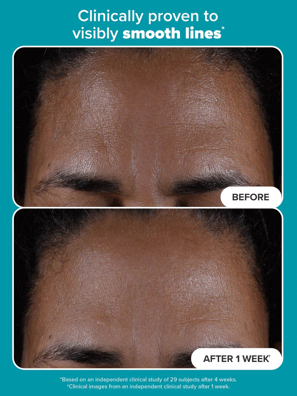 Paula’s Choice Exfoliator 118 ML
