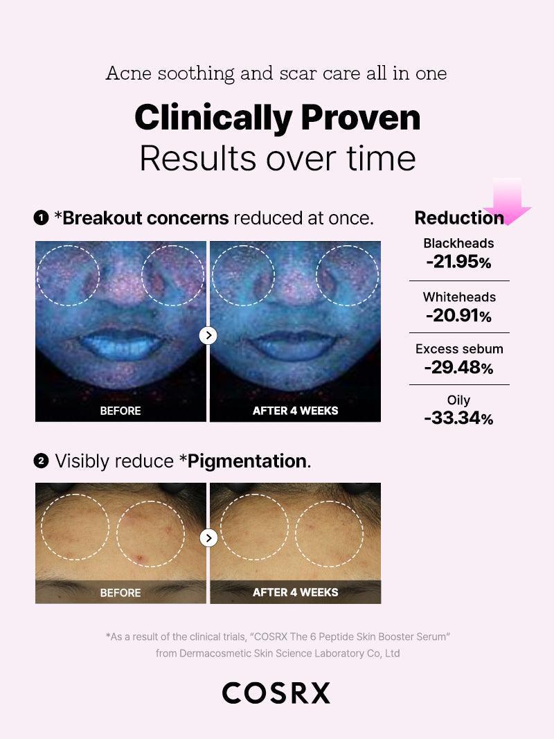 Cosrx The 6 Peptide Skin Booster Serum
