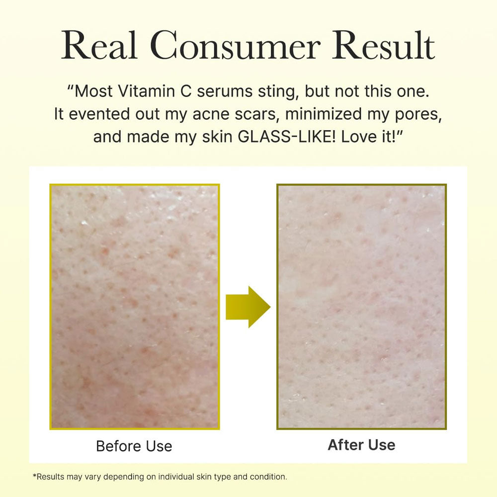 ARENCIA VITAMIN C BOOSTER SERUM 30 ML