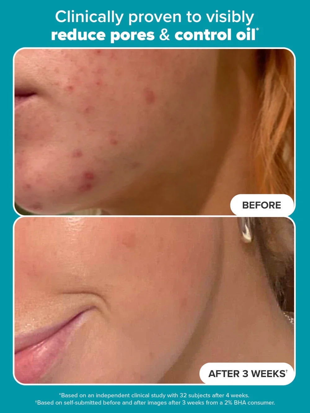 Paula’s Choice Exfoliator 118 ML