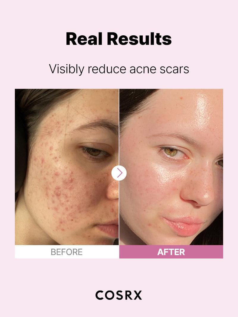 Cosrx niacinamide 15% Serum .