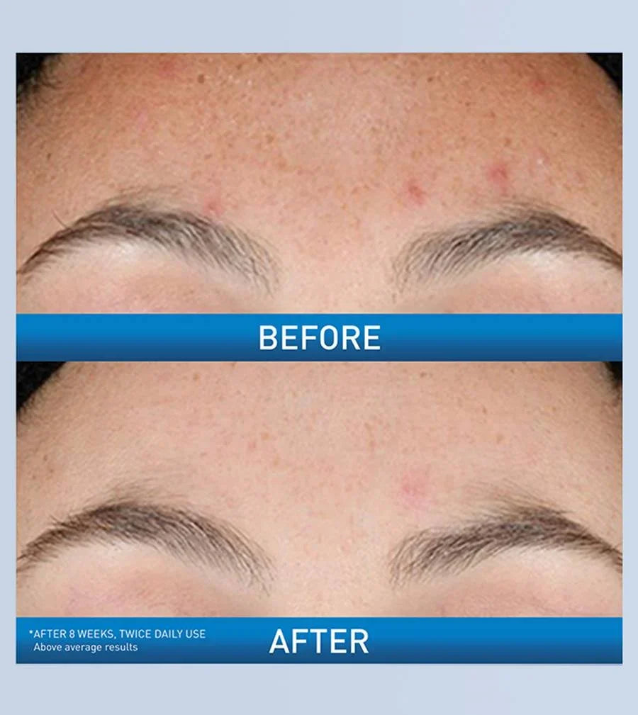 CeraVe Resurfacing Retinol Serum